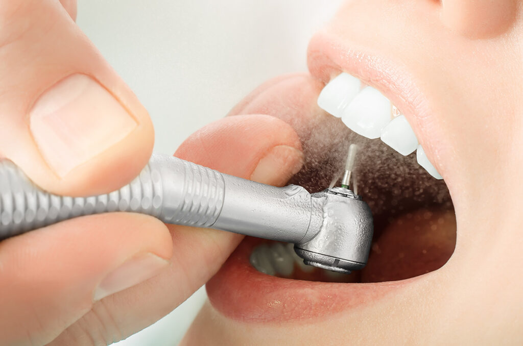 Tulip Dental Restorative Dentistry