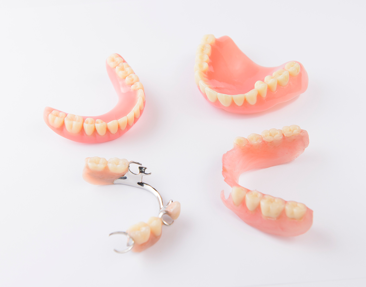 Conventional Full Dentures