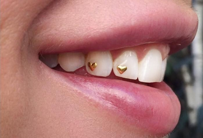 Tooth Gems - Swarovski Crystals